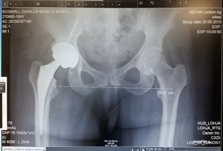 gunilla-roswall-xray